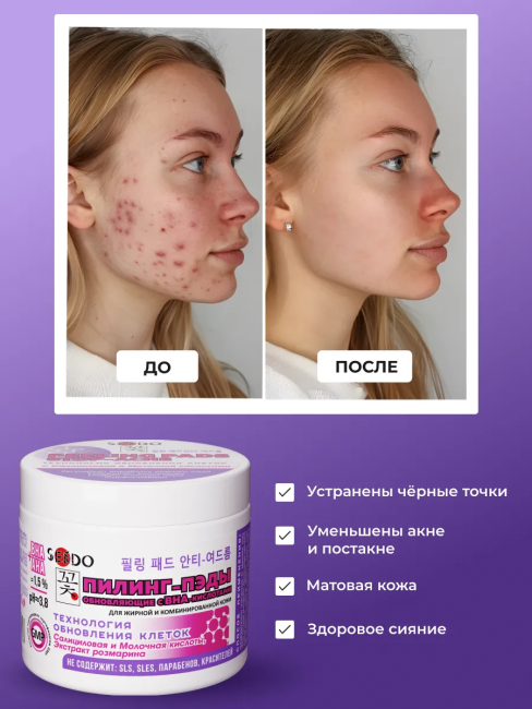 Пилинг-пэды с BHA-кислотами 80 мл PARLI Sendo 20 шт Пилинг-пэды с BHA-кислотами 80 мл PARLI Sendo 20 шт