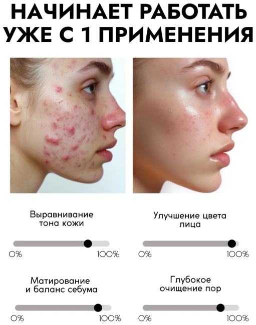 Гель для умывания с кислотами AHA+BHA Complex Cleansing Gel PARLI Sendo 200 мл