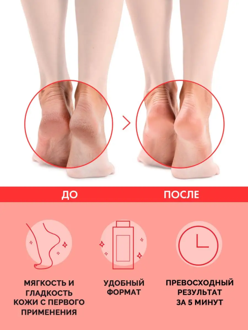 Профессиональный гель для педикюра SUPER ПЯТКИ 250 мл Профессиональный гель для педикюра SUPER ПЯТКИ 250 мл